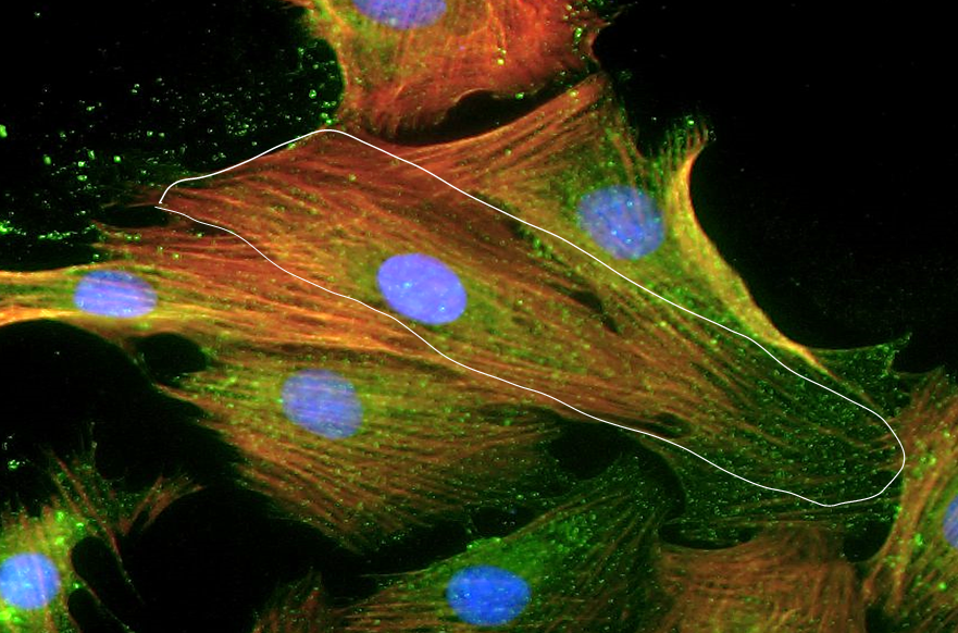 Whartan’s jelly stem cell derived cardiac like cells expressing β-MYH (green) F-actin (red)